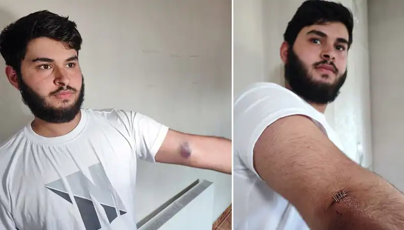Bahçeye Kaçan Top Sebebiyle Mahallede Şok Olay: Conolar Gelişini Kameraya Aldı