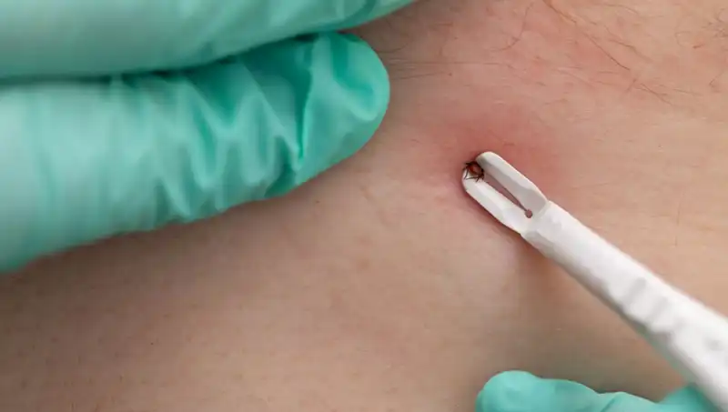 Kene Tehdidiyle İlgili Kritik Uyarı! Bu Belirtilere Dikkat Edin