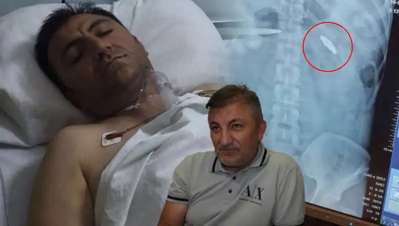 15 Temmuz’un Gölgesinde: Kurşunla Yaralananların Unutulmaz Hikayeleri